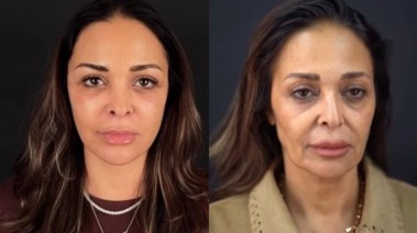 داليا البحيري بعد الفيس ليفتنج