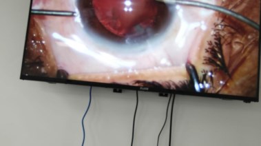 جراحات العين في مستشفى نجع حمادي العام 