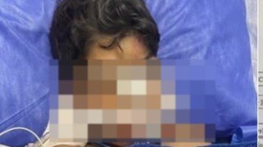 الطفل ياسين - الضحية