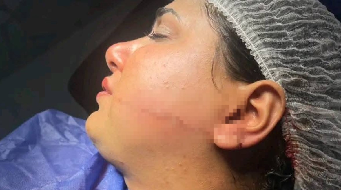 الفتاة المصابة