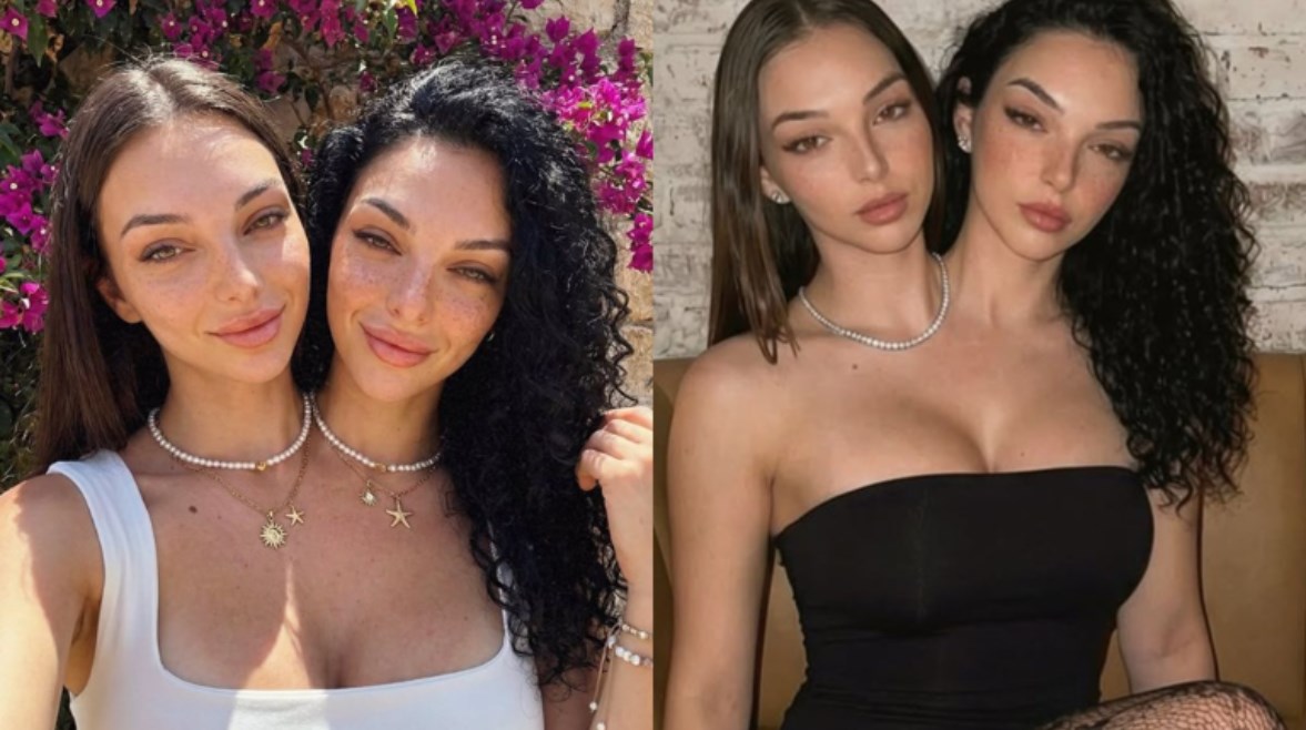  التوأمتان الملتصقتان، فاليريا وكاميلا