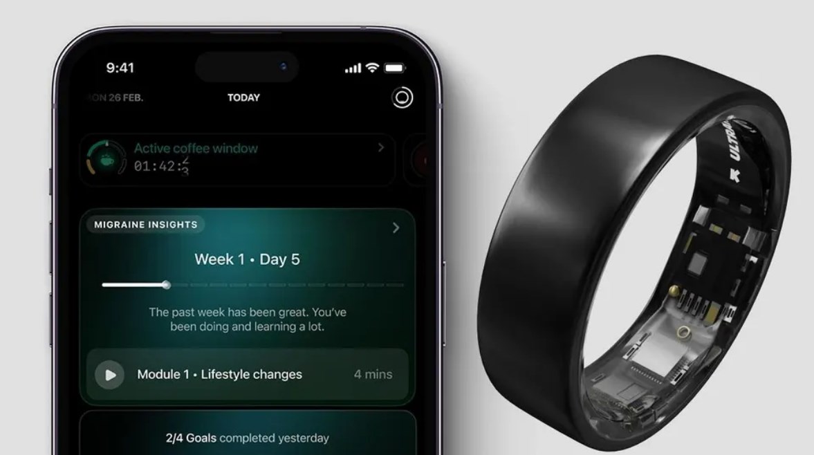 خاتم ذكي لعلاج الصداع النصفي