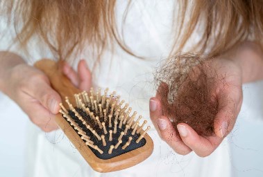 تساقط الشعر
