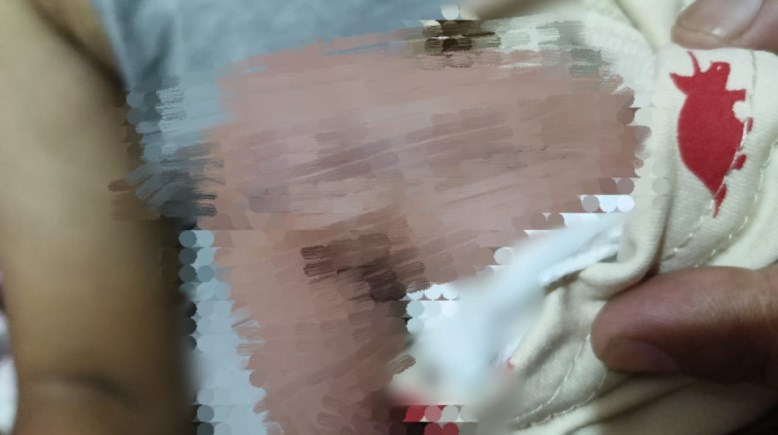 قدم الطفل محمود
