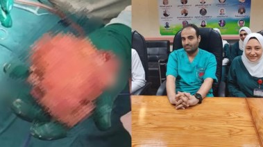 الفريق الطبي والجنين بداخل الرضيعة