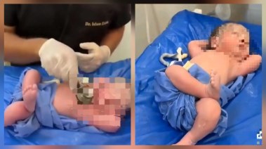صور الرضيع التي أثارت الجدل