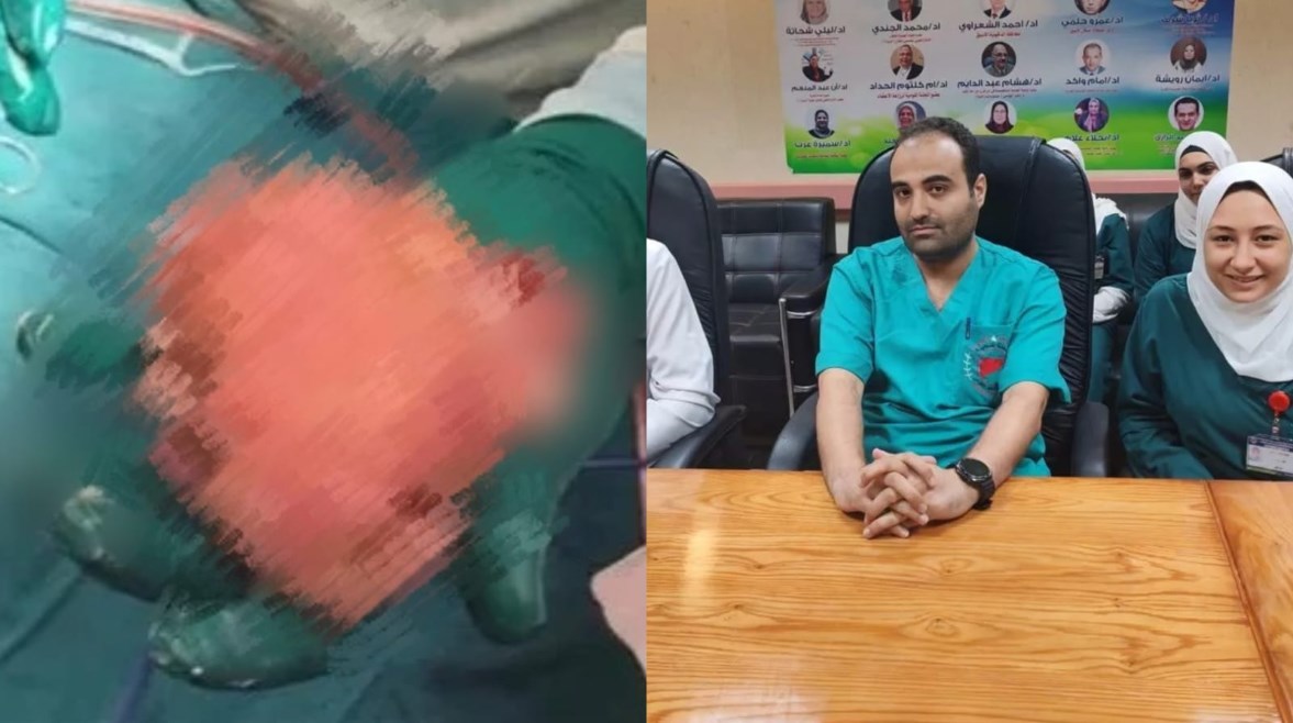 الفريق الطبي والجنين بداخل الرضيعة