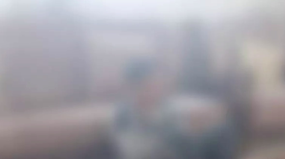 صورة لولد تم التعدي عليه بالضرب في الدار حسب رواية الشاب 