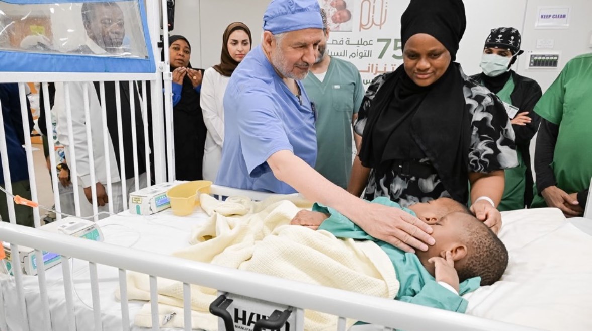 نجاح عملية فصل التوأم الملتصق التنزاني 