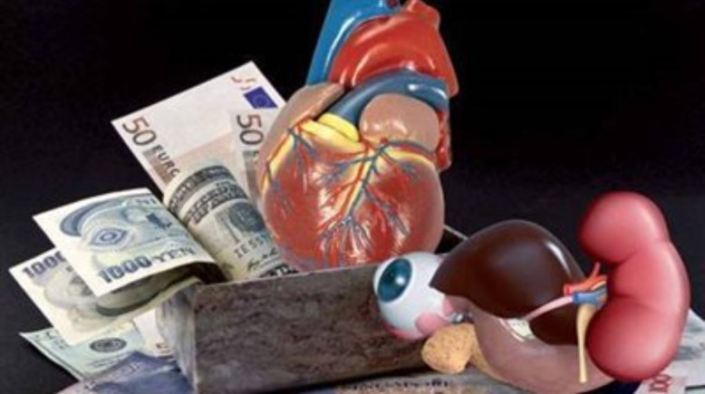 تجارة الأعضاء