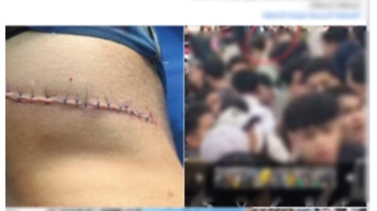 جانب من الواقعة 