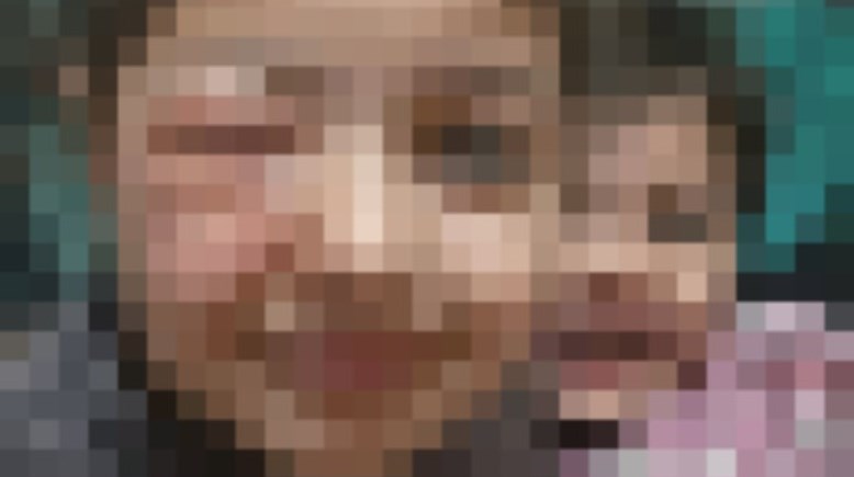 الطفلة المصابة 