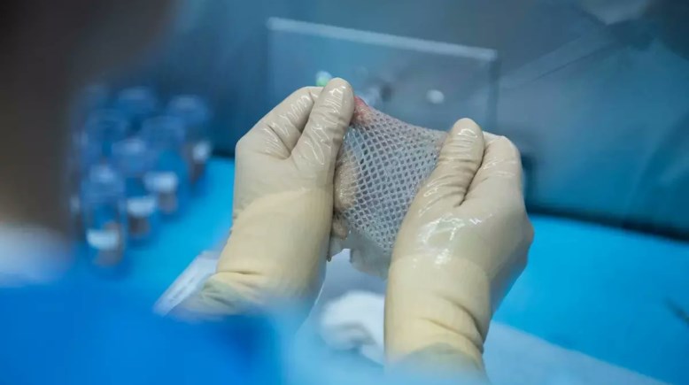 اقتراح بإنشاء بنك للأنسجة البشرية يثير الجدل