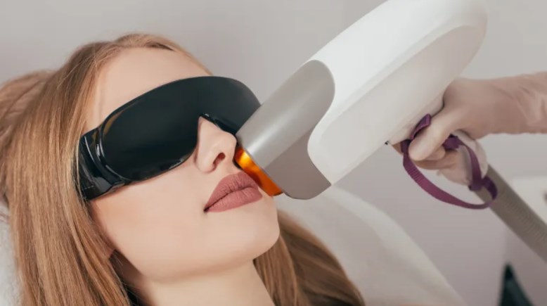 إزالة الشعر بالليزر