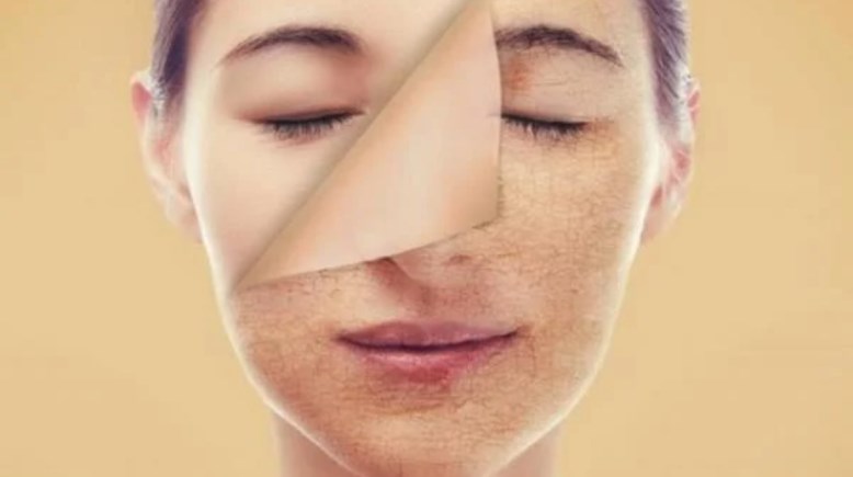 صيام البشرة