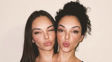 التوأم الملتصق