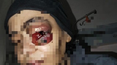 المريضة بعد تدهور حالتها الصحية