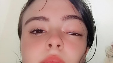 المريضة بعد تدهور حالتها الصحية