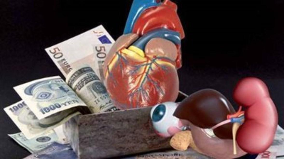 تجارة الأعضاء