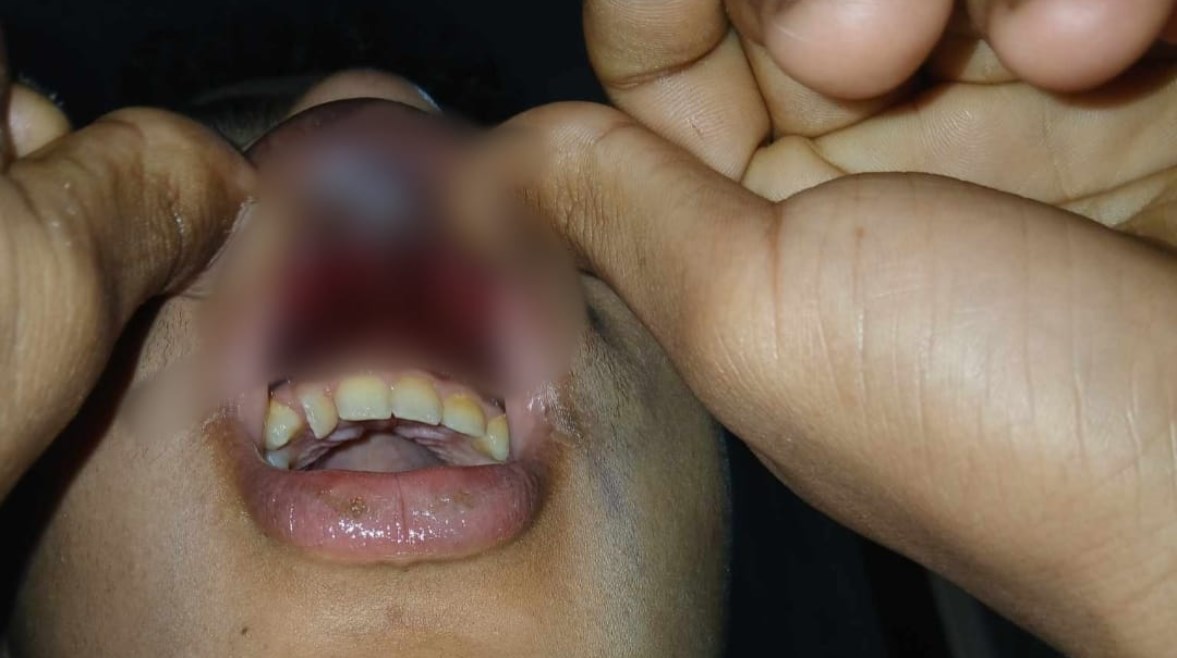 المجني عليه 