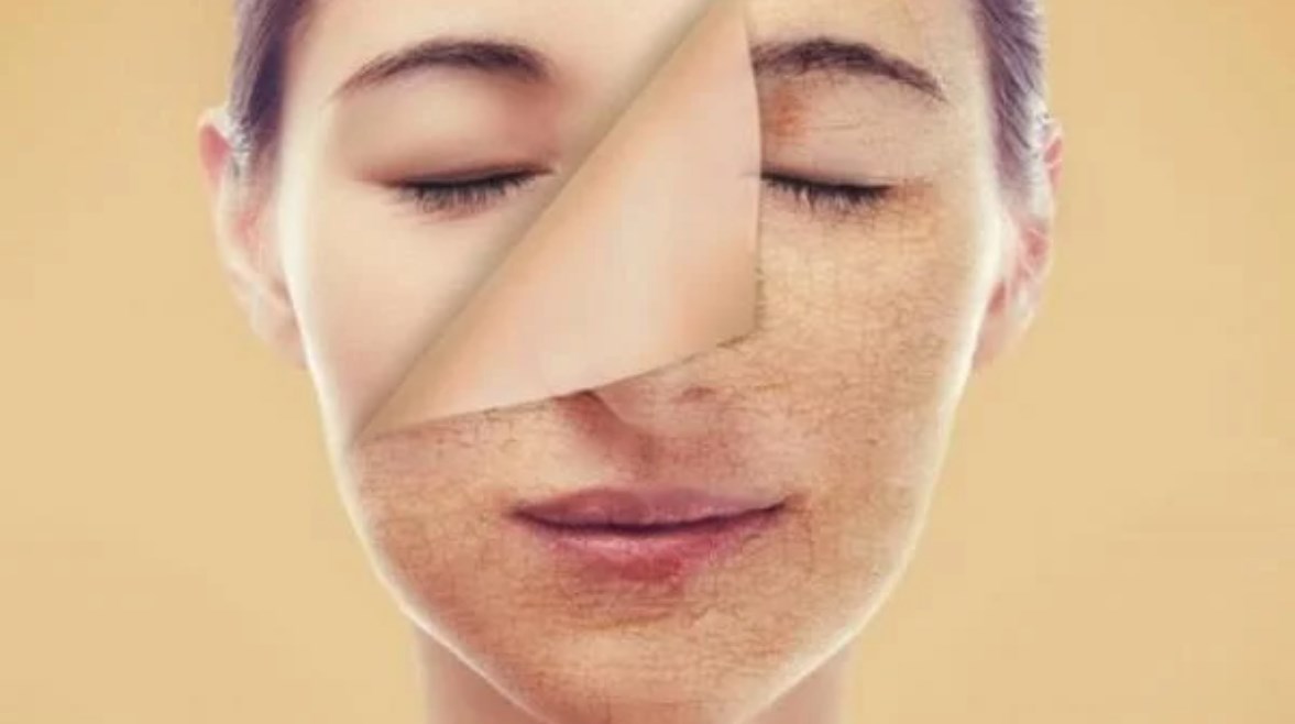 صيام البشرة