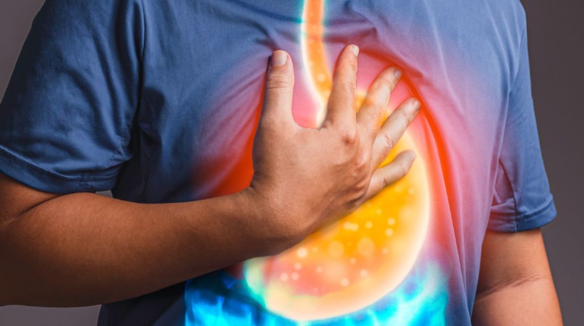 حموضة المعدة