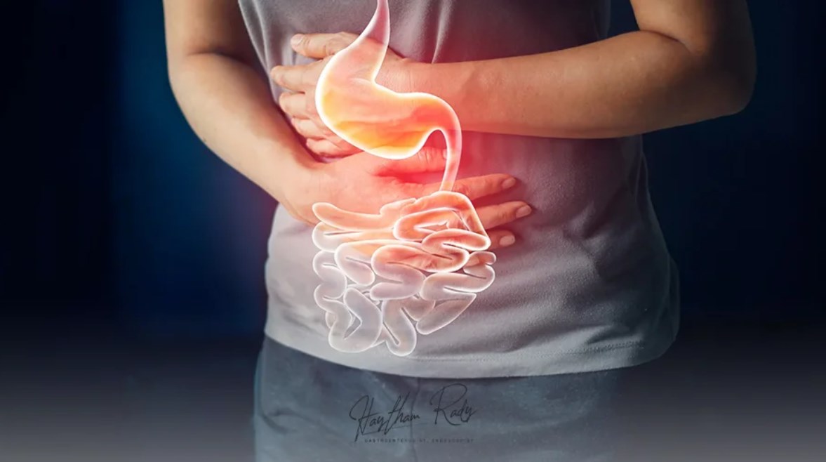 اضطرابات الهضم