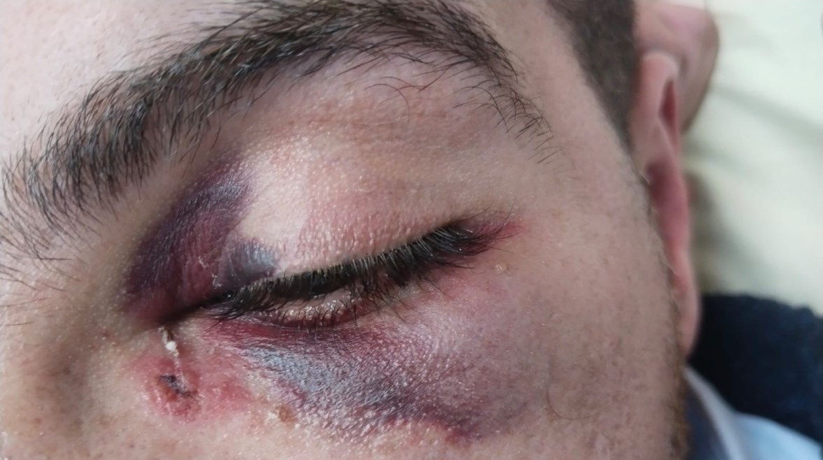 إصابة طبيب المنوفية