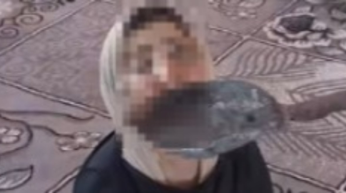 فتاة البشعة