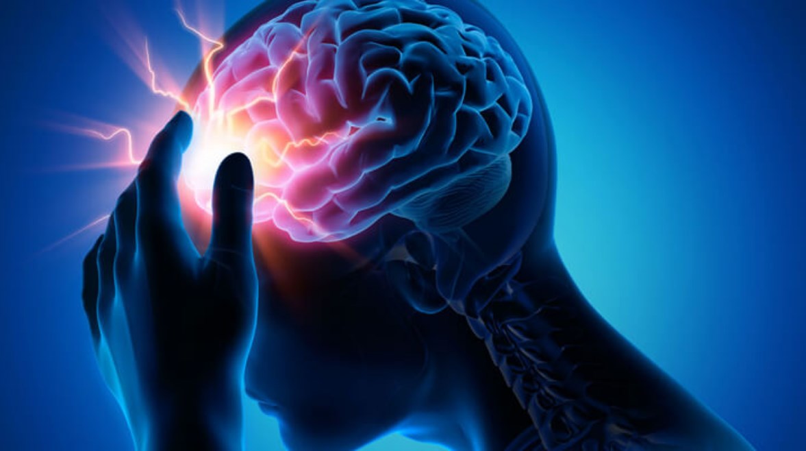 السكتة الدماغية - أرشيفية