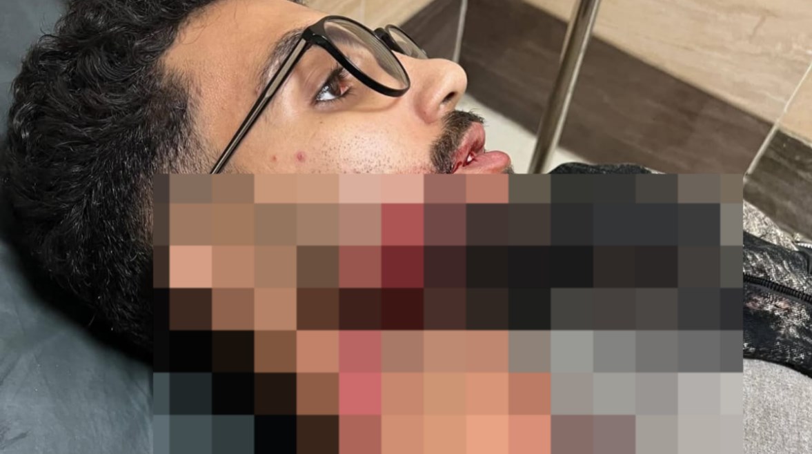 المجني عليه حمدي