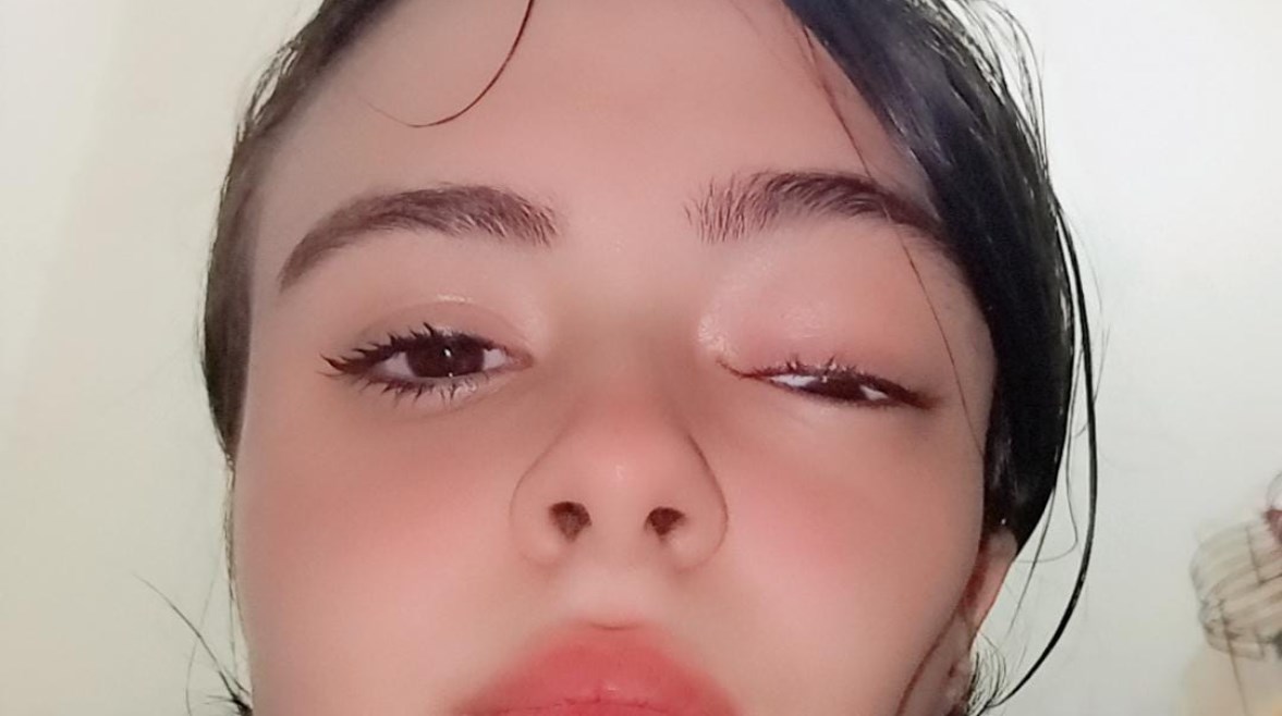 المريضة بعد تدهور حالتها الصحية