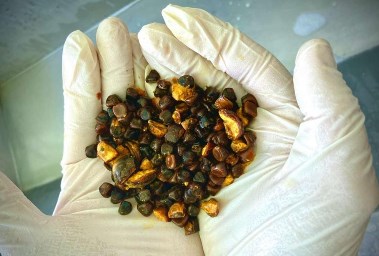 حصى المرارة البقرية