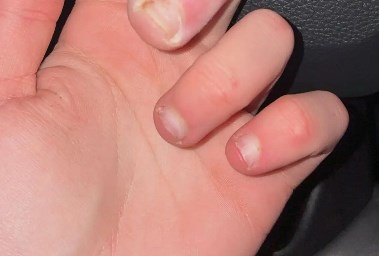 أصابع جابي سويرزوسكي