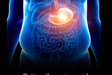 طرق علمية جديدة لعلاج السمنة