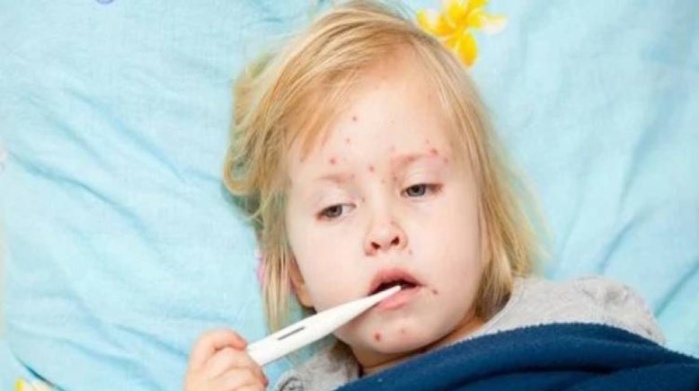  الالتهاب السحائي...أرشيفية