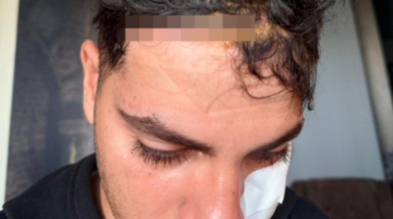 الطالب المصاب