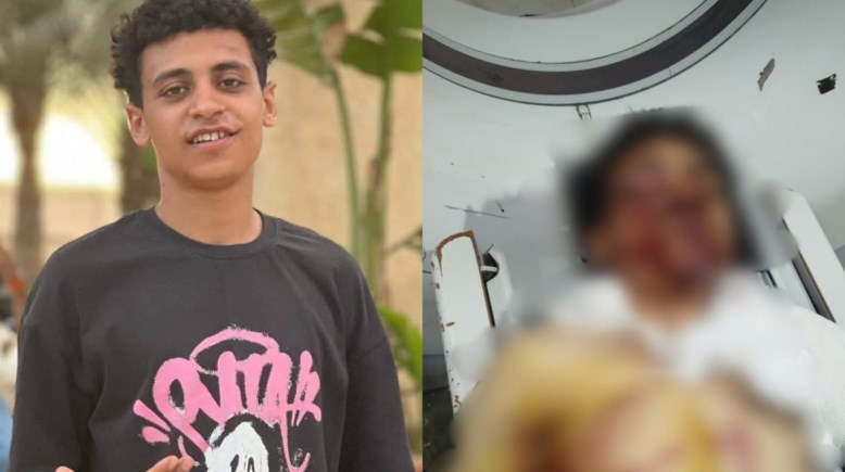 محمد عبدالله ضحية واقعة علم إسرائيل بكرداسة