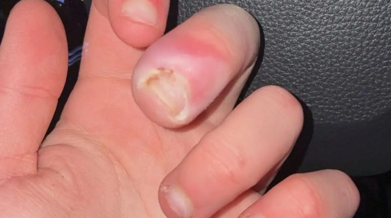 أصابع جابي سويرزوسكي