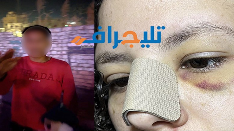 القبض على السايس في واقعة الاعتداء على مندوبة دعاية طبية ببني سويف