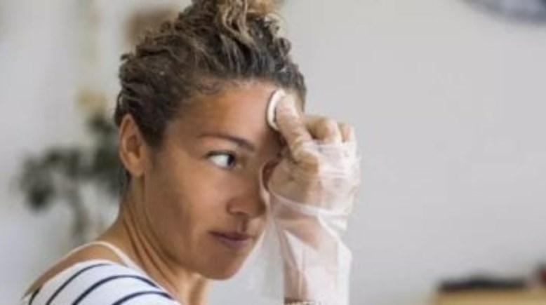 إزالة صبغة الشعر من البشرة 