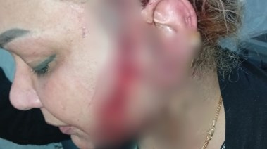 "هند" ضحية طليقها بالسيدة زينب 