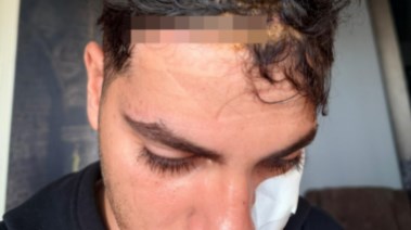 الطالب المصاب