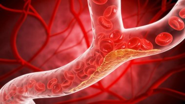 هل تغير قواعد الوقاية من أمراض القلب؟