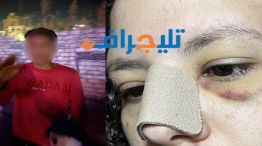 القبض على السايس في واقعة الاعتداء على مندوبة دعاية طبية ببني سويف