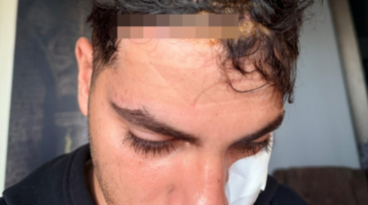 الطالب المصاب