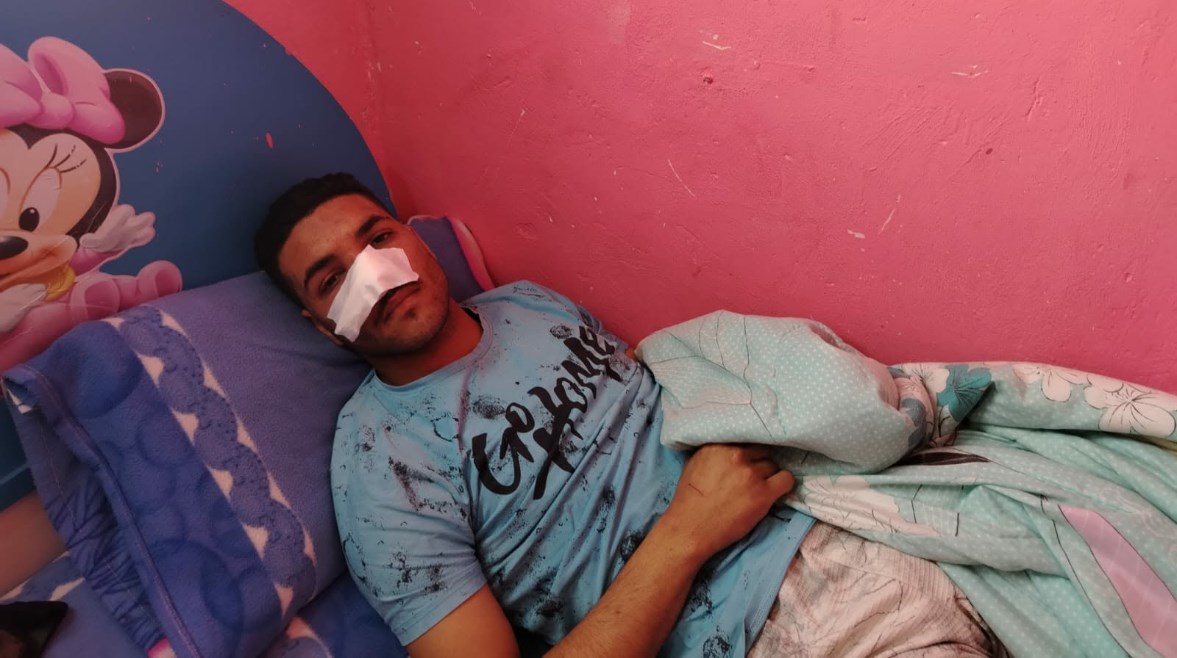 "كنت هدافع حتى لو مش أختي".. شاب بورسعيد يروي تفاصيل الاعتداء الوحشي عليه بعد تصديه للتحرش بالفتيات