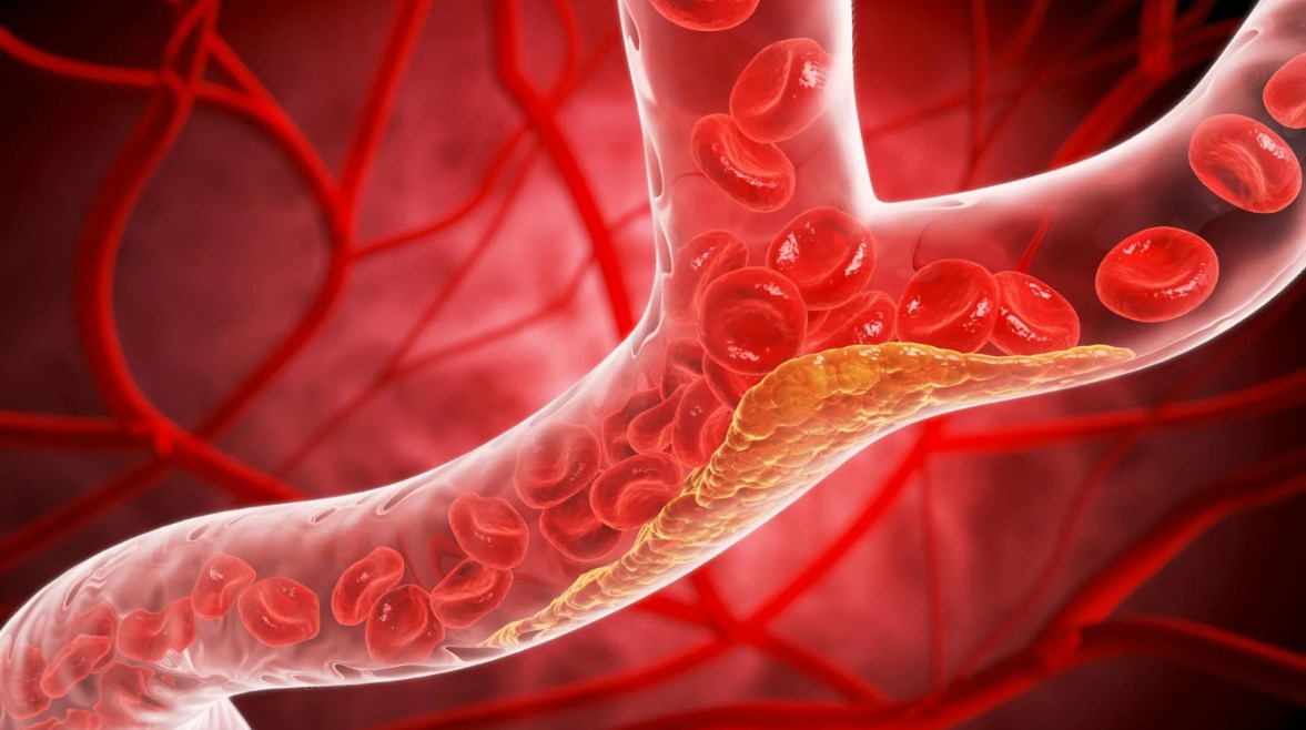 هل تغير قواعد الوقاية من أمراض القلب؟