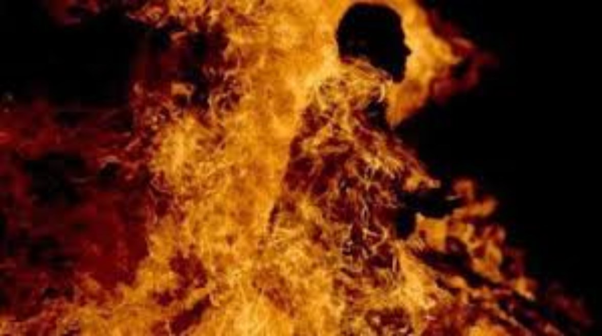  أشعل النيران في جسده- أرشيفية