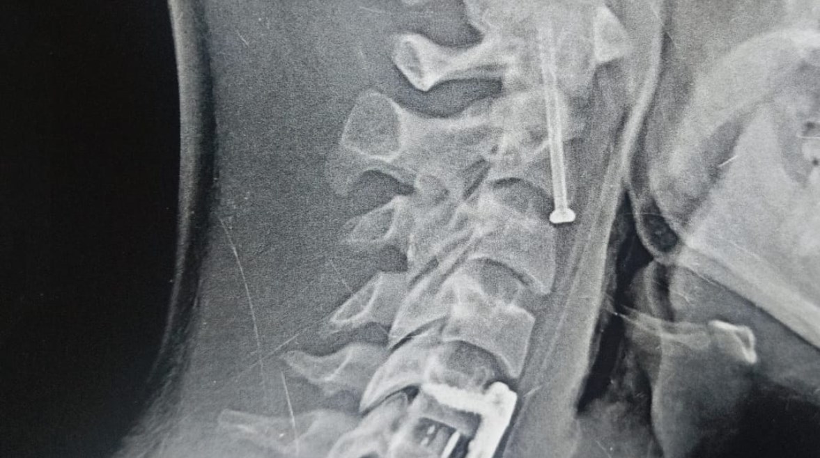 أشعة أجريب للمريض